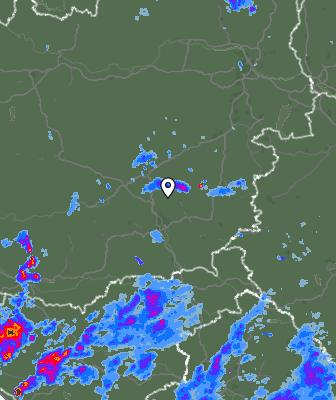 Radar