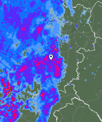 Radar