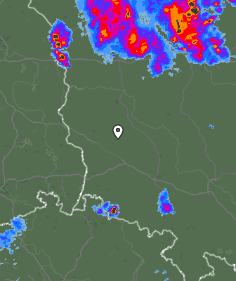 Radar