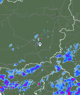 Radar