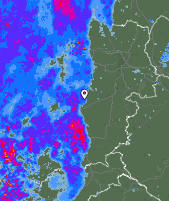 Radar