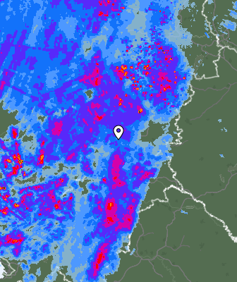 Radar