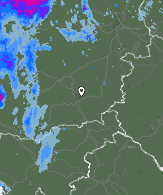 Radar