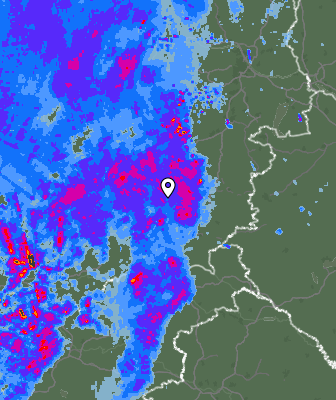 Radar