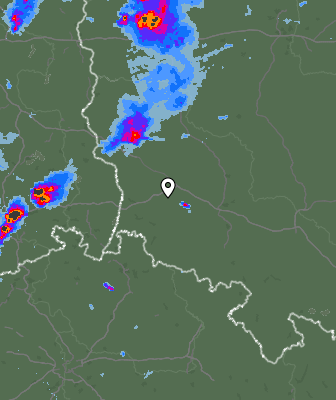 Radar
