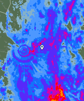Radar