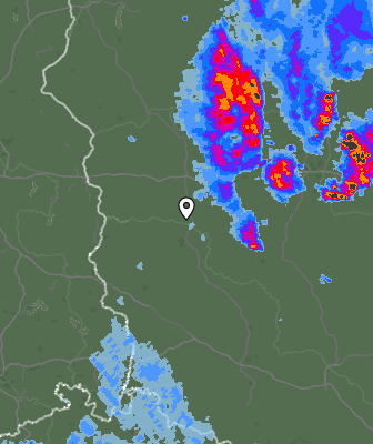 Radar