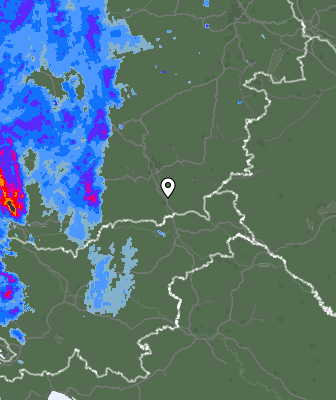 Radar