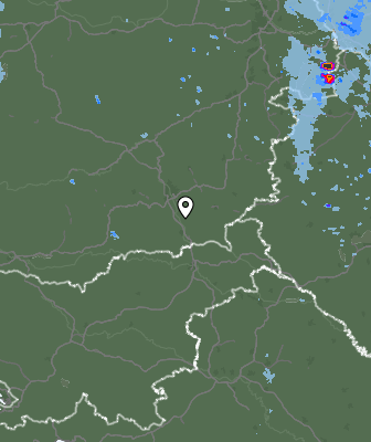 Radar