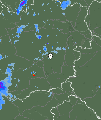 Radar