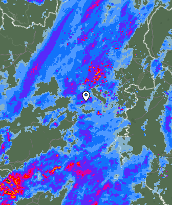 Radar