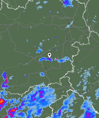 Radar