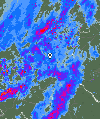 Radar