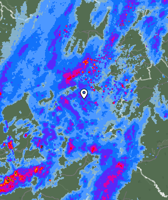 Radar