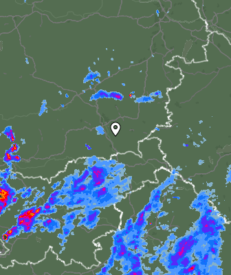 Radar