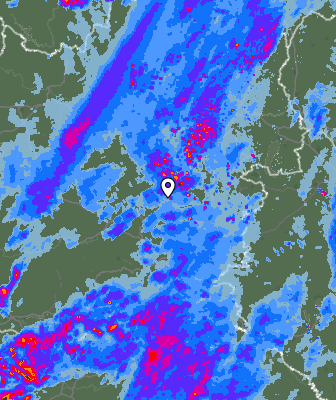 Radar