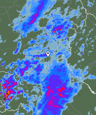 Radar