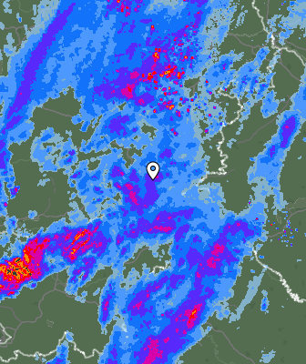 Radar