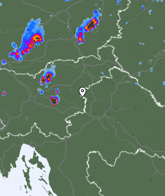 Radar