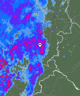 Radar