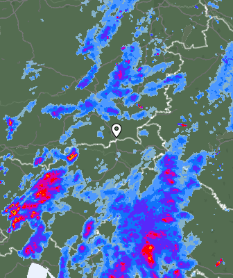 Radar