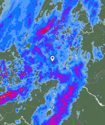 Radar