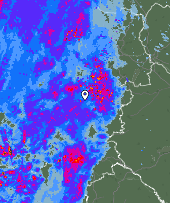 Radar