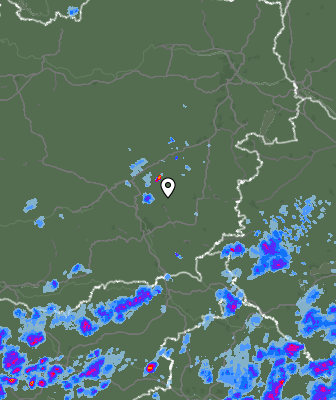 Radar
