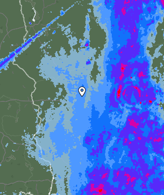 Radar
