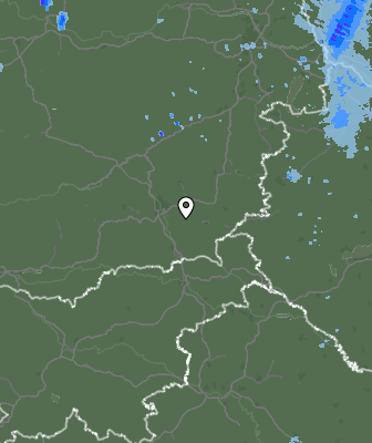 Radar