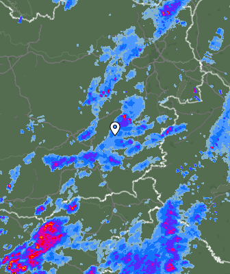 Radar