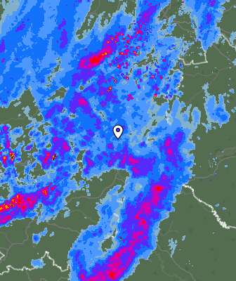 Radar