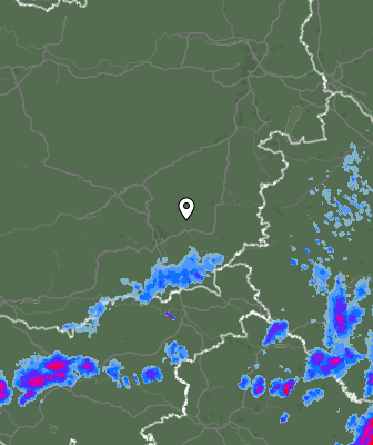 Radar