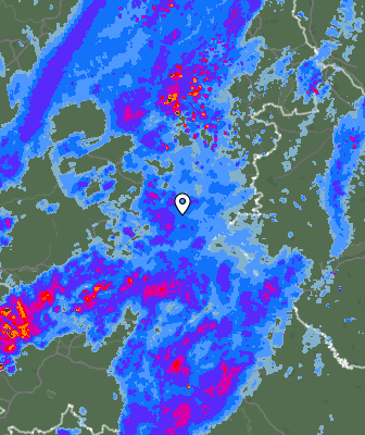 Radar