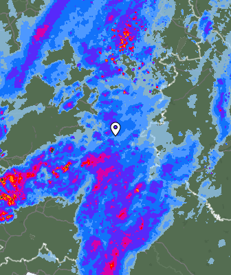 Radar