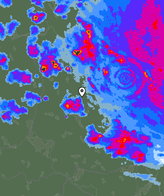 Radar