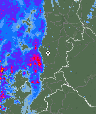Radar