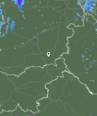 Radar