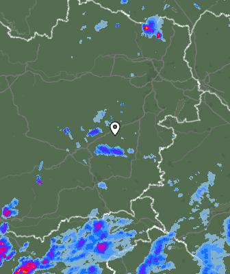Radar