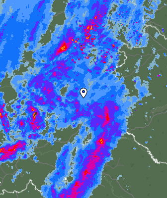 Radar