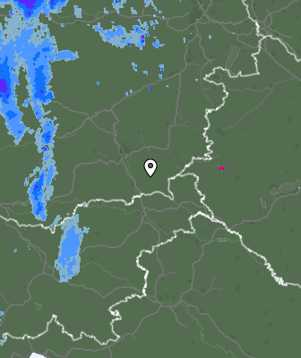 Radar