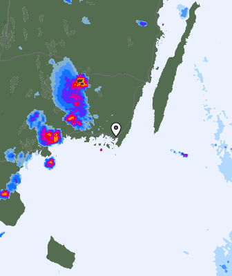 Radar