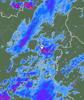 Radar