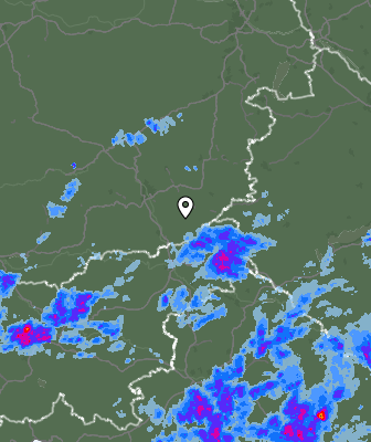 Radar