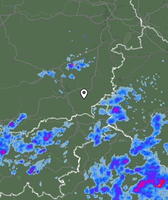 Radar