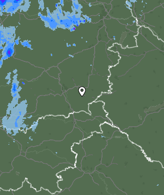Radar