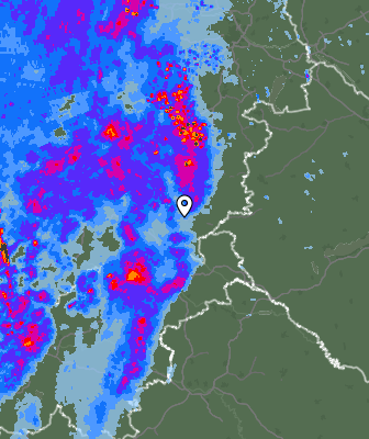 Radar