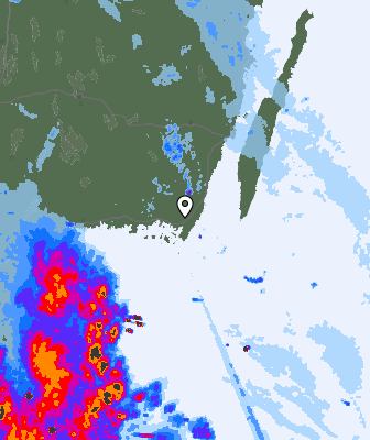 Radar