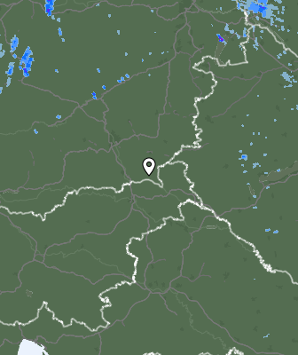 Radar