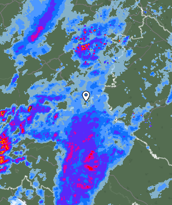 Radar